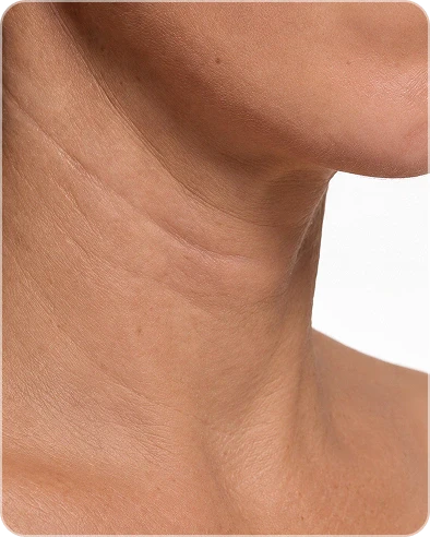 Standard Neck Cream